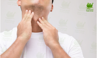 Hyperthyroidism Hyperthyroidism