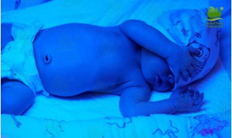 Jaundice Jaundice
