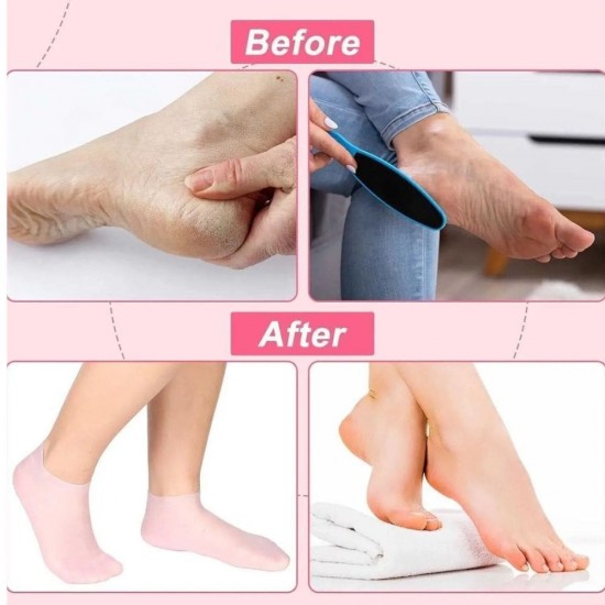 Silicone Foot Care Socks, Deep Moisturizing & Exfoliating Spa Socks for Cracked Heels & Dry Feet