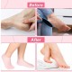 Silicone Foot Care Socks, Deep Moisturizing & Exfoliating Spa Socks for Cracked Heels & Dry Feet