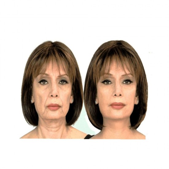Face Lift Tape - 5 Meter Wrinkle Prevention & Anti-Aging Face Lifting Tape Face Lift Tape - 5 Meter Wrinkle Prevention & Anti-Aging Face Lifting Tape