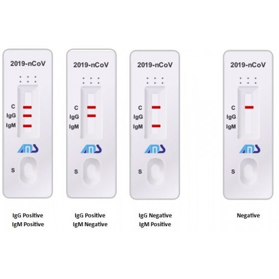 Coronavirus Rapid Test Kit, COVID-19 Antibody Test Kit, COVID-19 Rapid Test Kit IgG + IgM, 96% Accuracy in 10-15 Minutes, Made in UK, 2 Complete Tests in One Kit  